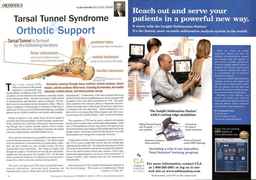 Tarsal Tunnel Syndrome & Orthotic Support