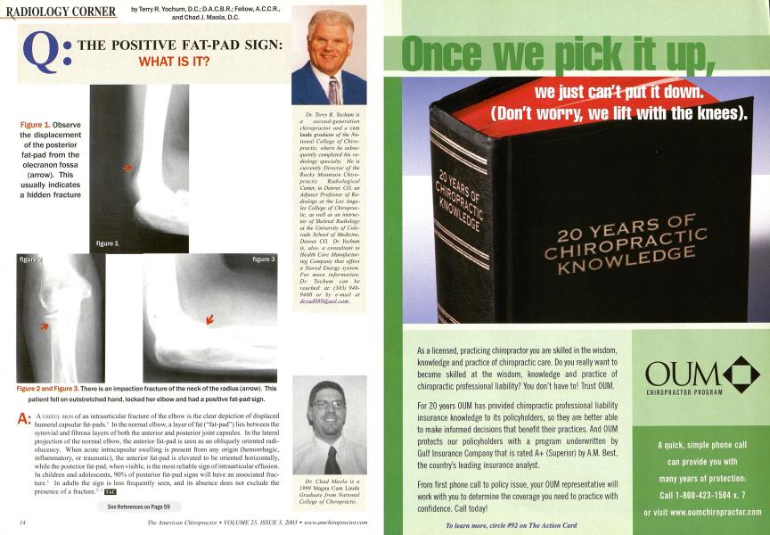 Q: THE POSITIVE FAT-PAD SIGN: WHAT IS IT?