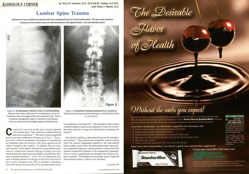 Lumbar Spine Trauma