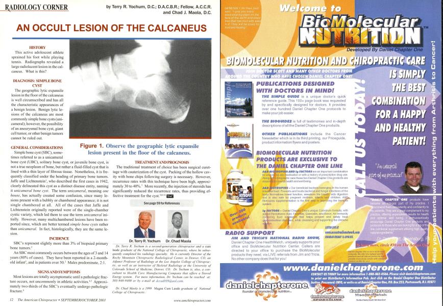 AN OCCULT LESION OF THE CALCANEUS
