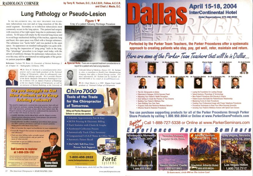 Lung Pathology or Pseudo-Lesion
