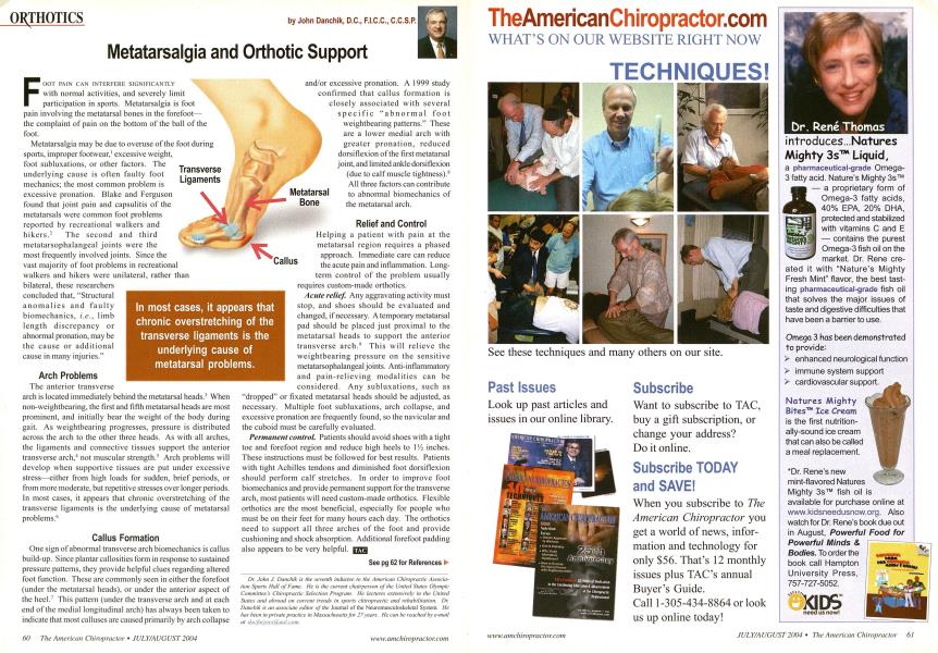 Metatarsalgia and Orthotic Support