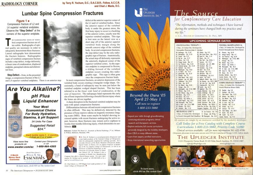 Lumbar Spine Compression Fractures