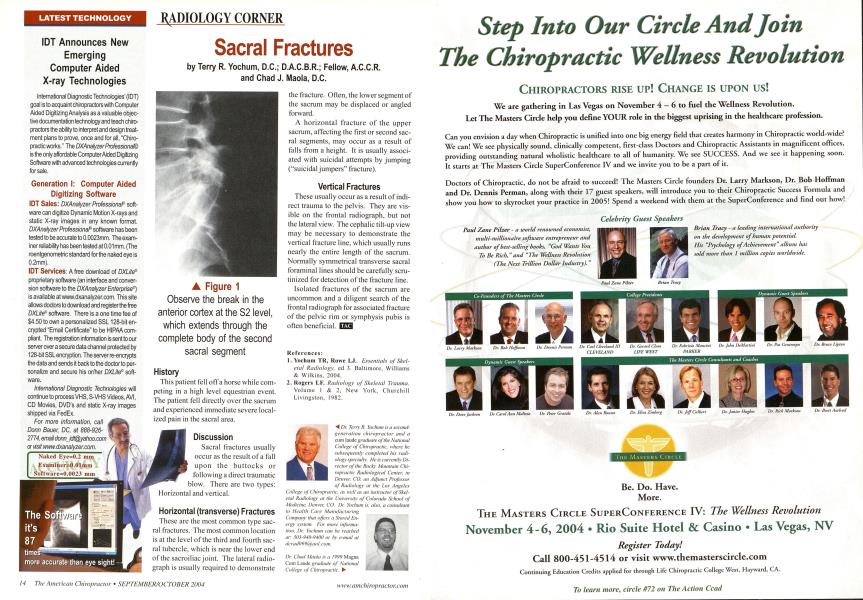 Sacral Fractures