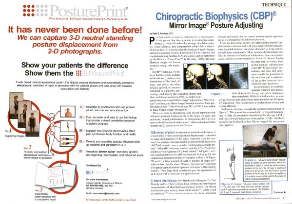 Chiropractic Biophysics (CBP) Mirror Image Posture Adjusting