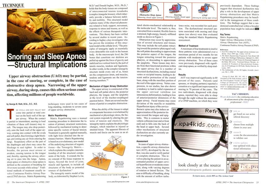 Snoring and Sleep Apnea Structural Implications