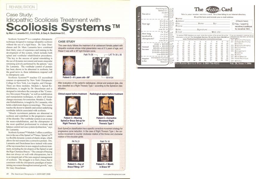 Case Study: Idiopathic Scoliosis Treatment with Scoliosis Systems