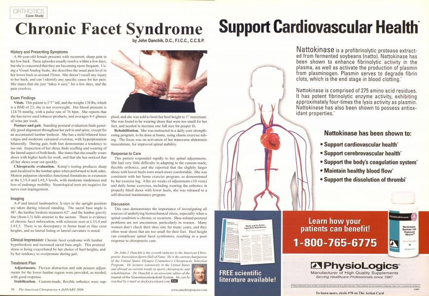 Chronic Facet Syndrome