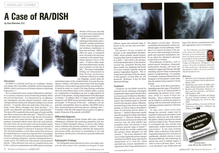 A Case of RA/DISH
