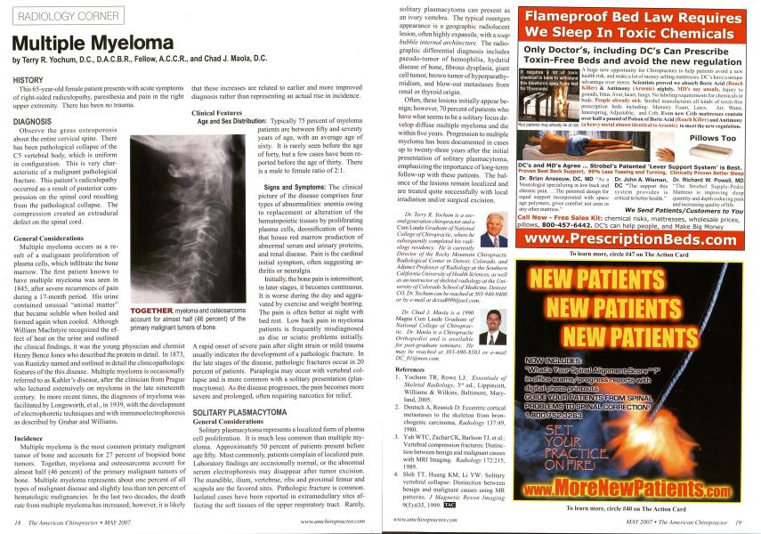 Multiple Myeloma