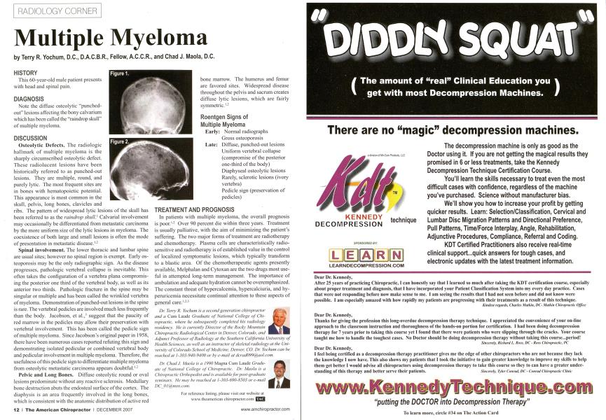 Multiple Myeloma