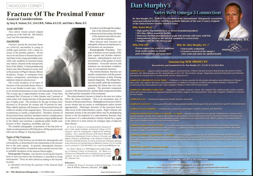 Fracture Of The Proximal Femur General Considerations
