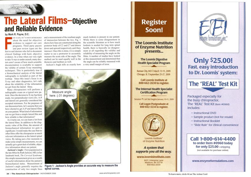 The Lateral Films--objective and Reliable Evidence