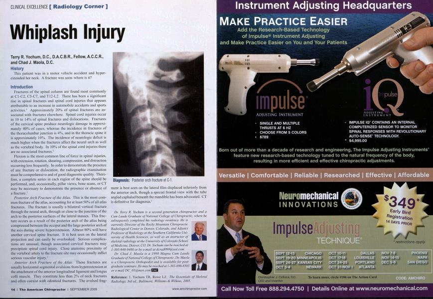 Whiplash Injury