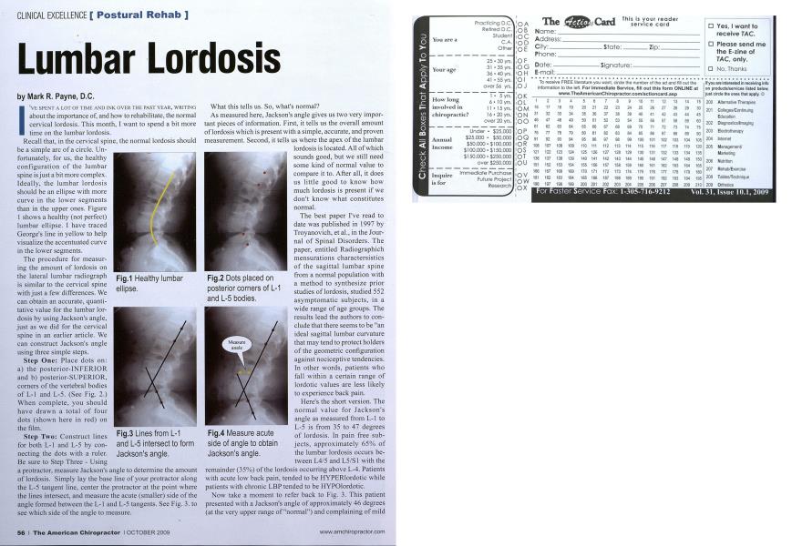 Lumbar Lordosis
