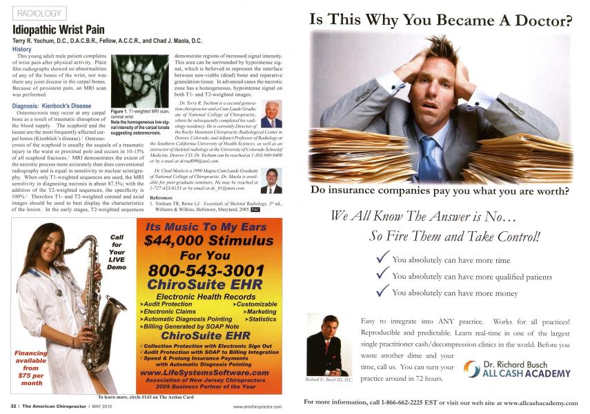 Idiopathic Wrist Pain
