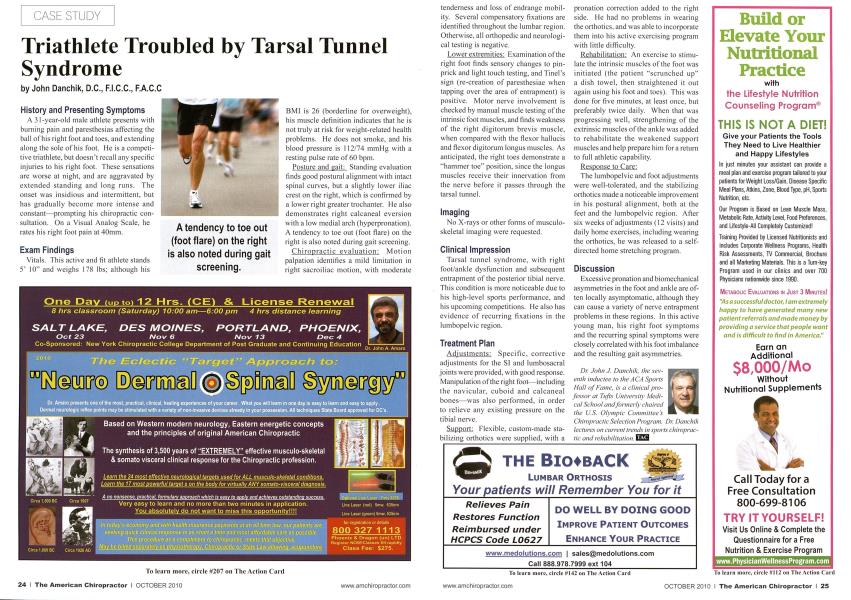 Triathlete Troubled by Tarsal Tunnel Syndrome