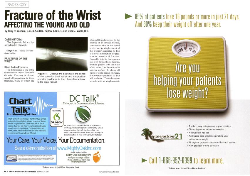 Fracture of the Wrist AFFECTING THE YOUNG AND OLD