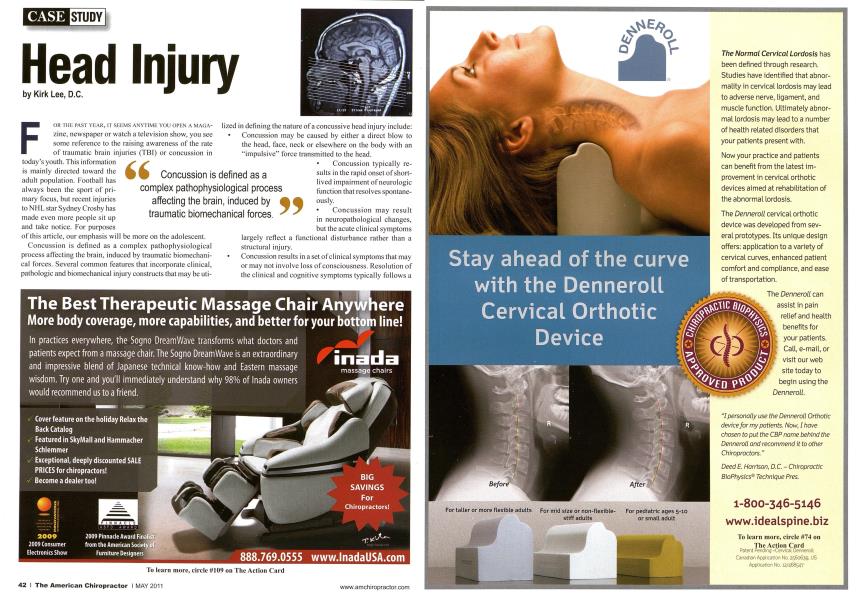 Head Injury