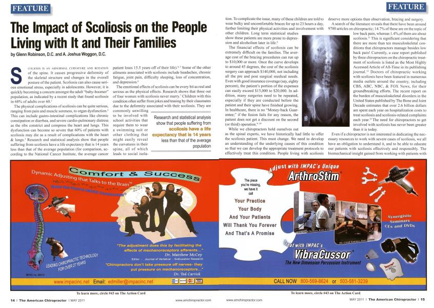 The Impact of Scoliosis on the People Living with It and Their Families