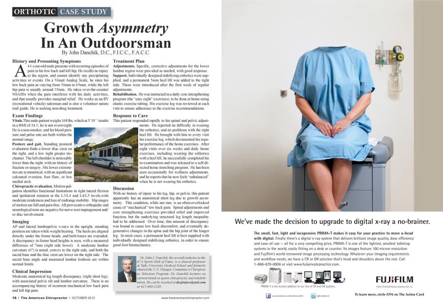 Growth Asymmetry In An Outdoorsman