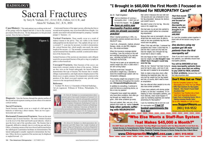 Sacral Fractures