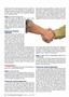 Page: - 20 | The American Chiropractor