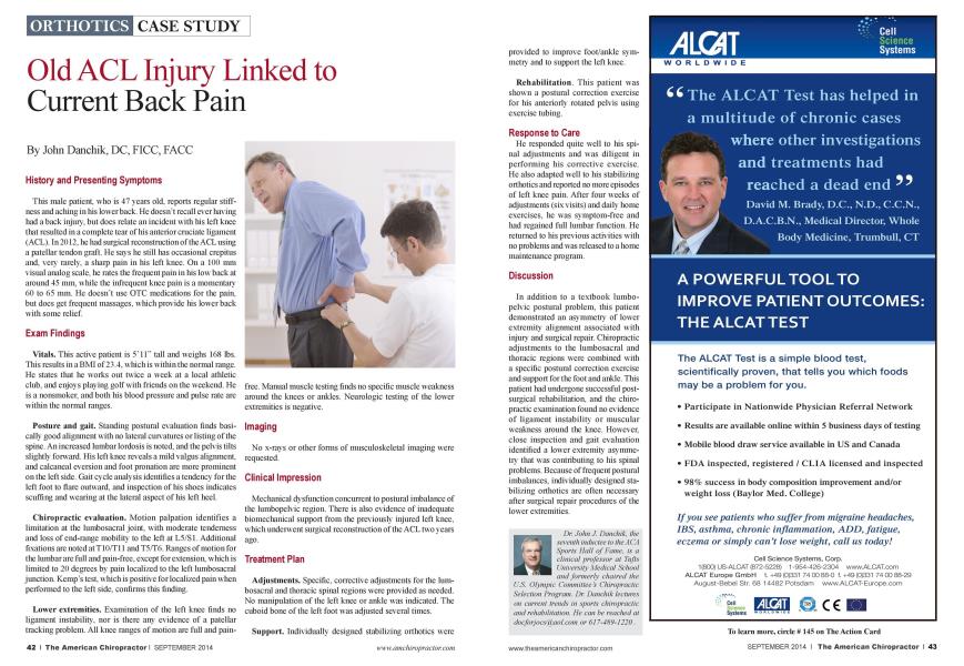 Old ACL Injury Linked to Current Back Pain