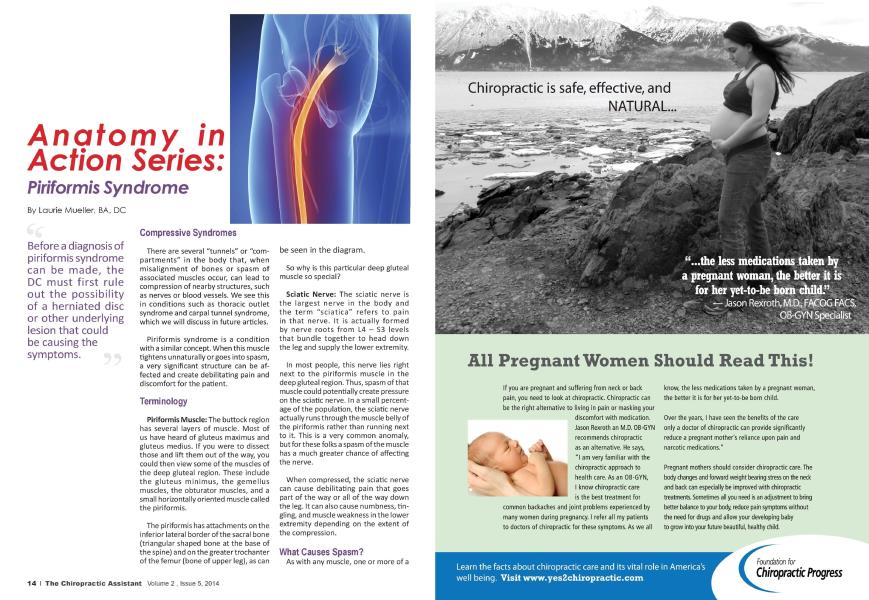 Anatomy in Action Series: Piriformis Syndrome