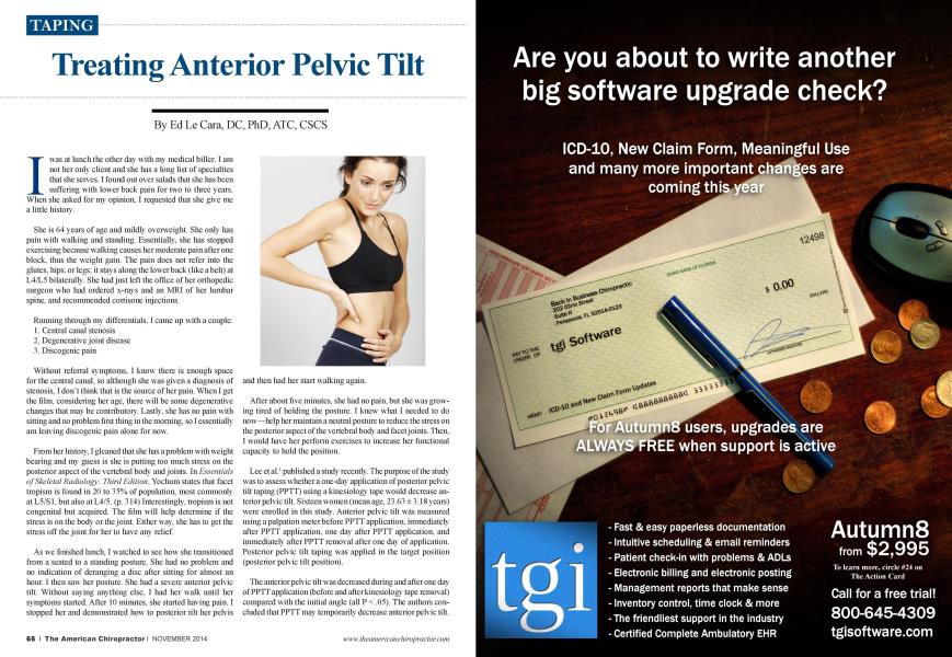 Treating Anterior Pelvic Tilt