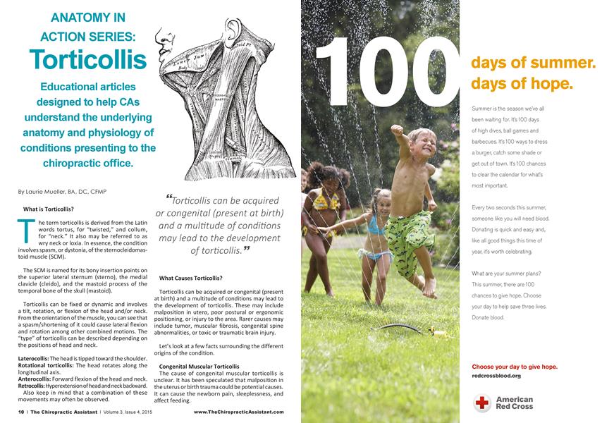 ANATOMY IN ACTION SERIES: Torticollis