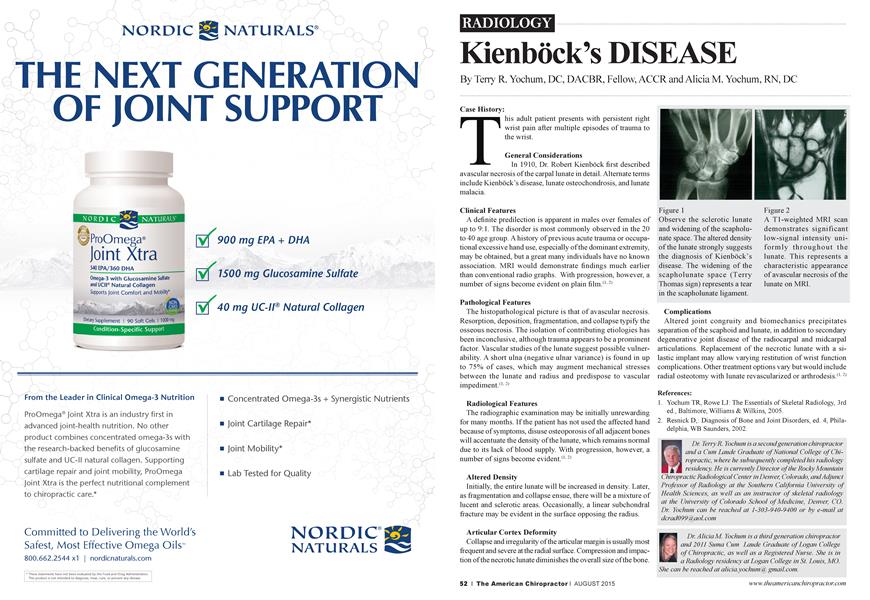 Kienböck’s DISEASE