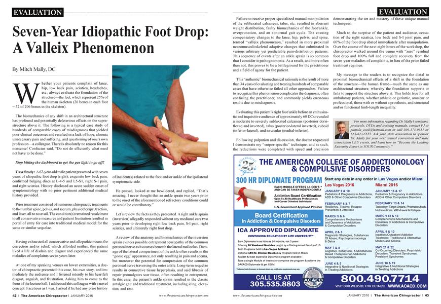 Seven-Year Idiopathic Foot Drop: A Valleix Phenomenon