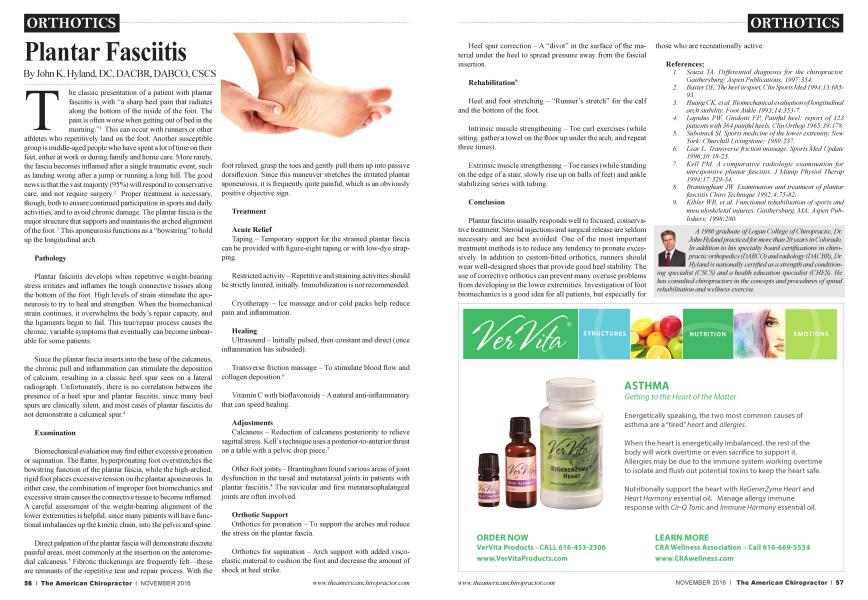 Plantar Fasciitis