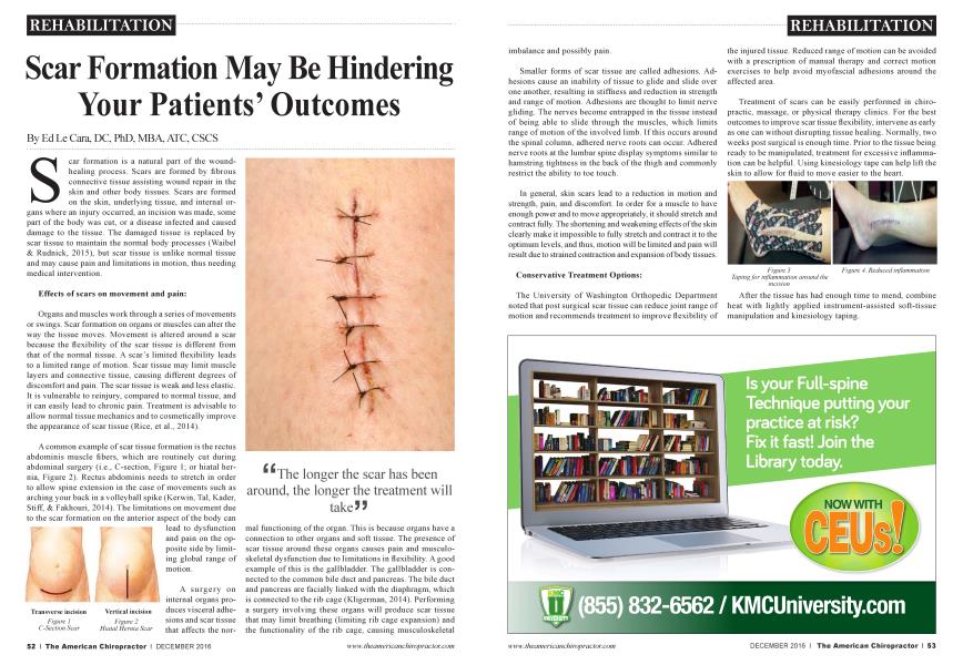 Scar Formation May Be Hindering Your Patients’ Outcomes