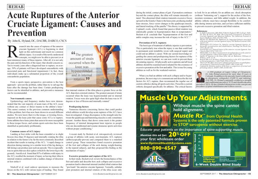 Acute Ruptures of the Anterior Cruciate Ligament: Causes and Prevention