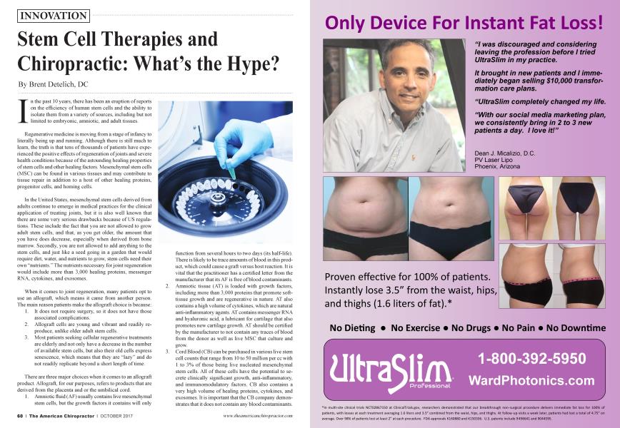 Stem Cell Therapies and Chiropractic: What’s the Hype?