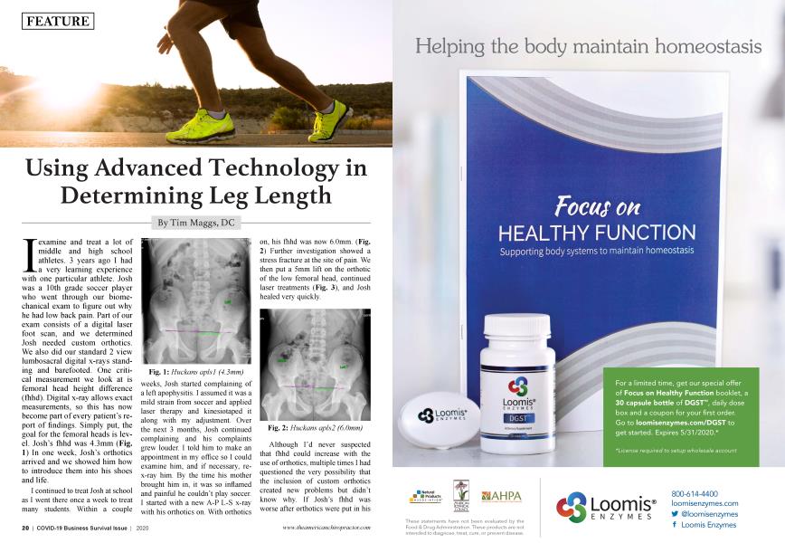 Using Advanced Technology in Determining Leg Length
