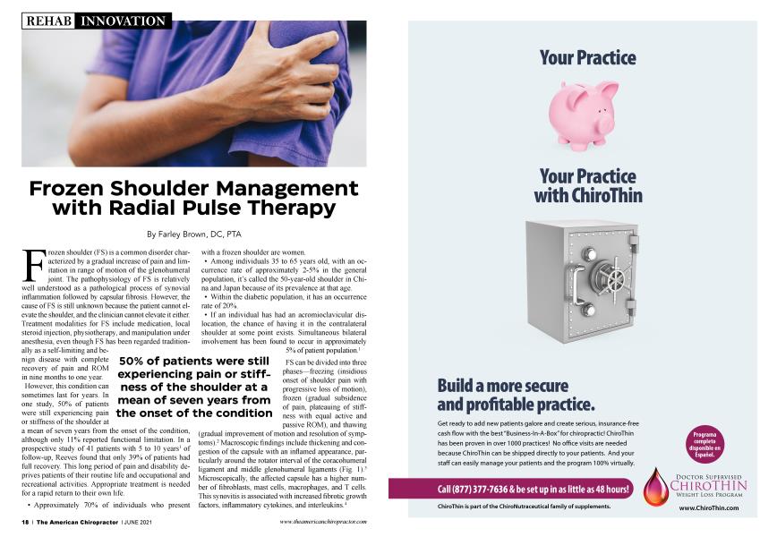 Frozen Shoulder Management with Radial Pulse Therapy