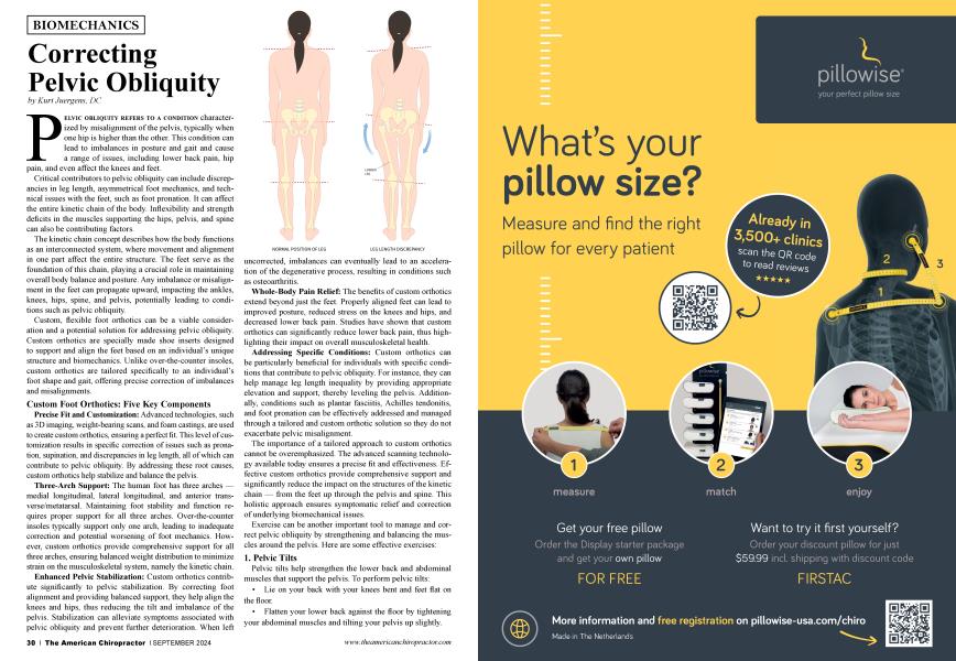 Correcting Pelvic Obliquity