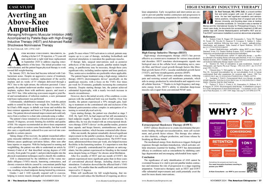 Averting an Above-Knee Amputation