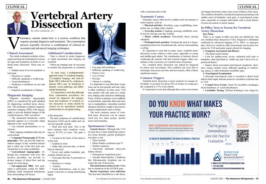 Vertebral Artery Dissection