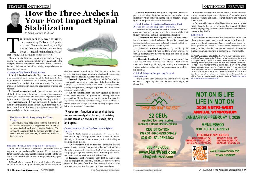How the Three Arches in Your Foot Impact Spinal Stabilization